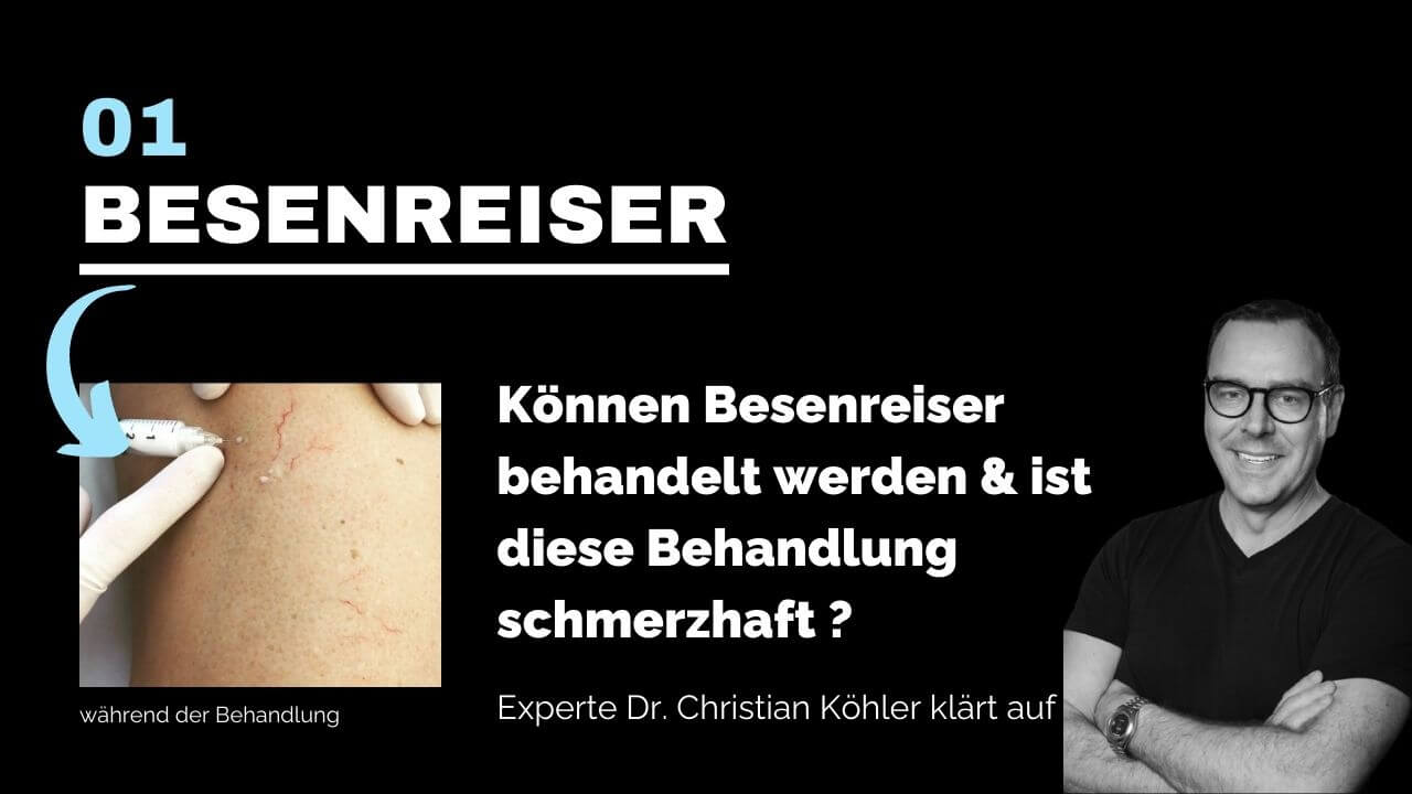 Besenreiser entfernen, prevention-center für Faltenunterspritzung und ästhetische Medizin in Bern